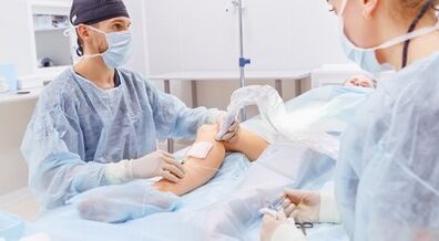 Operazione per vene varicose